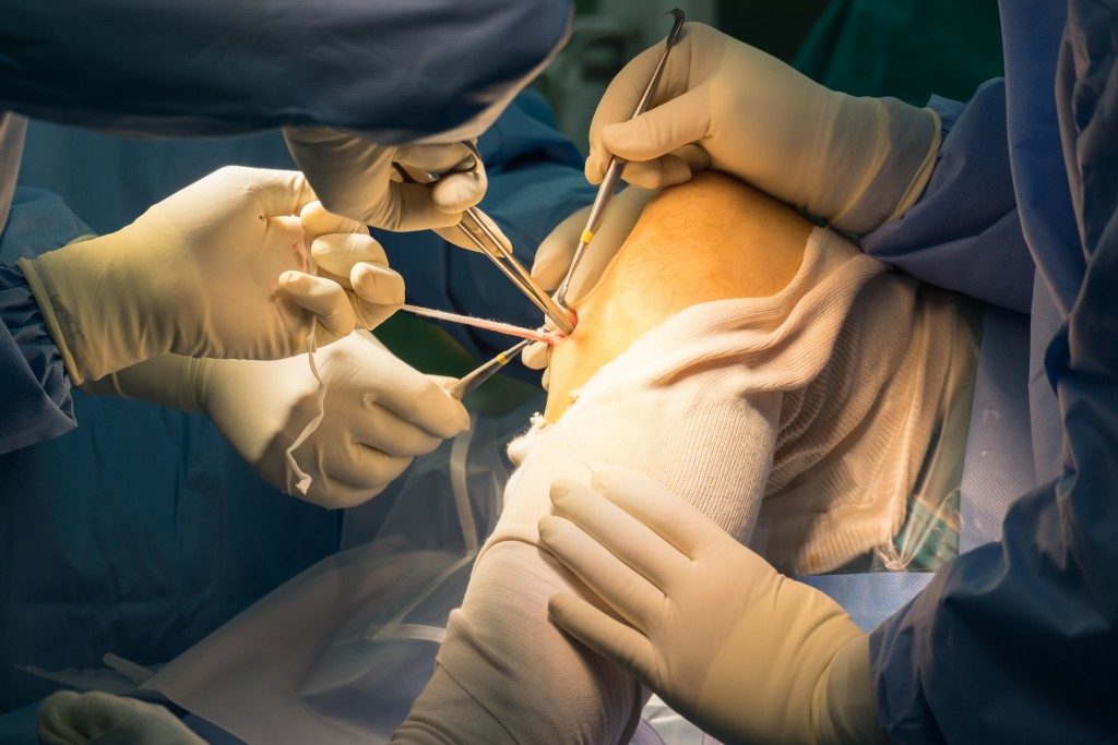 Knee under surgery